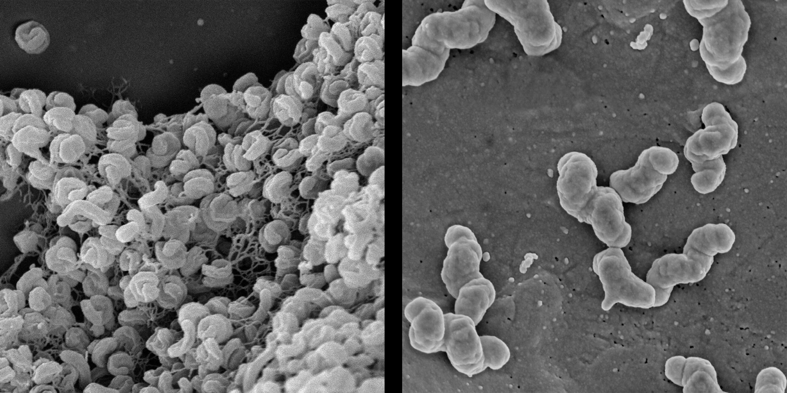 Bacterias Nitrospira vistas al microscopio